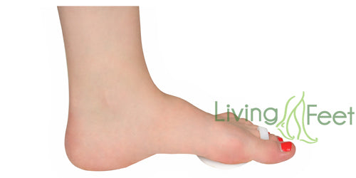 Forfodsstøtte med tåring