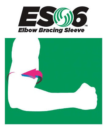 OS1st ES6 Albuebind