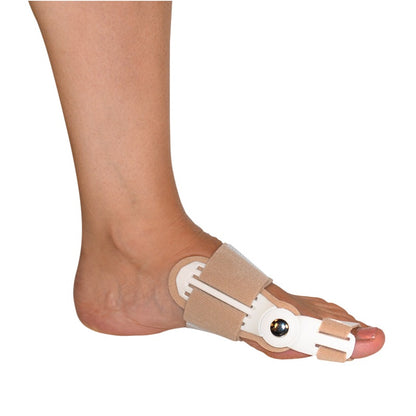 Natskinne ved knyst og skæv tå (hallux valgus)