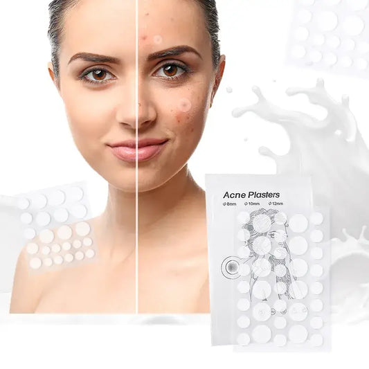 Pimple Patch mod akne