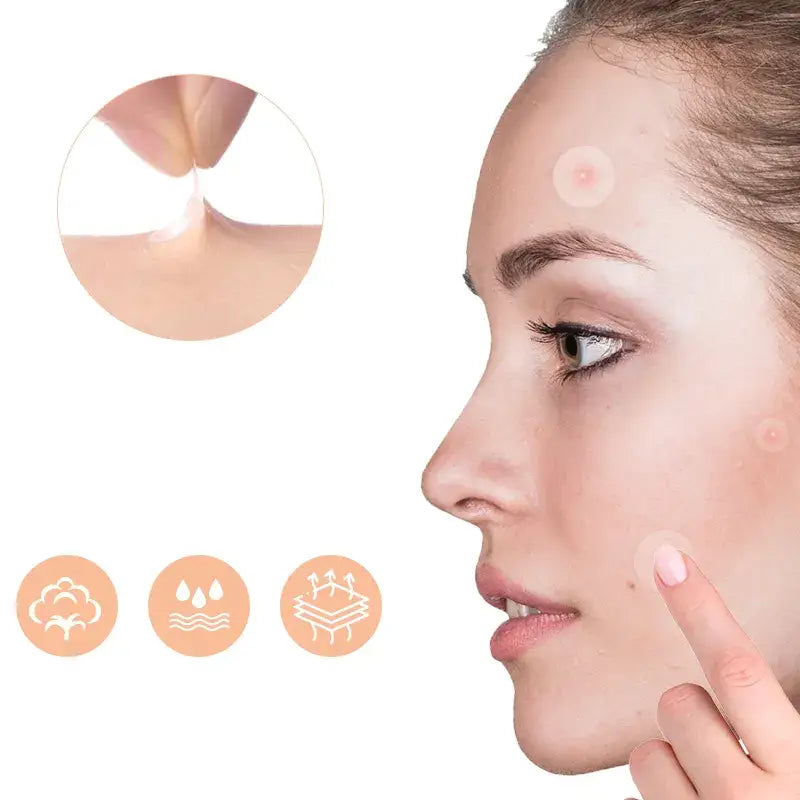 Pimple Patch mod akne