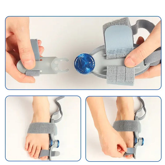 Hallux valgus-korrigerer med justerbart drejehjul