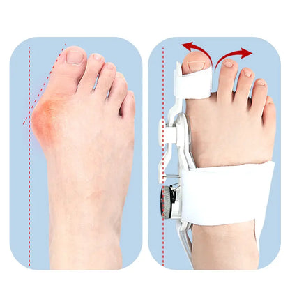 Justerbar natskinne til Hallux Valgus